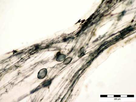 Morfotyp Glomus C.