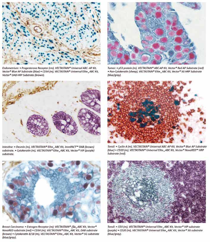Avidin-biotin komplex (ABC) Přizpůsobení VECTASTAIN ABC Kitu pro Vás Není-li VECTASTAIN ABC systém k dispozici s biotinylovanou sekundární protilátkou s požadovanou specifičností, můžete si vytvořit