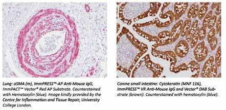 V případě dvoufázového ImmPRESS Excel Amplified Polymer Staining kitu je třeba brát v úvahu i druh amplifikace protilátky (vyrobeného v koze).