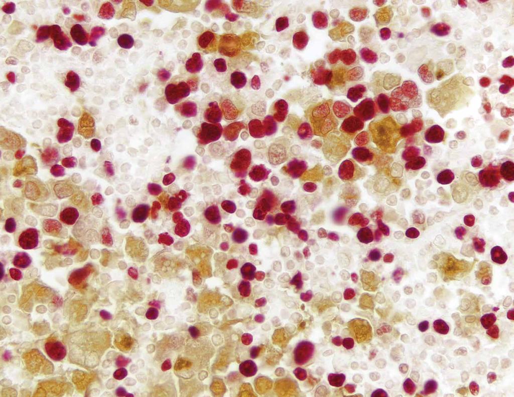 Porovnání detekčních systémů Vybíráme detekční systém Dle enzymu, citlivosti, ceny, použití biotinu, flexibility a časových nároků, vyberte detekční systém vhodný pro váš experiment.