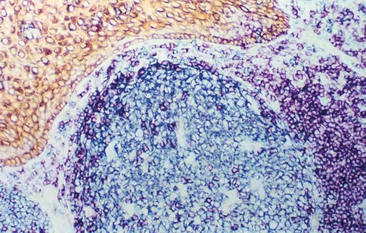 Avidin-biotin komplex (ABC) VECTASTAIN ABC kity Peroxidázové kity Peroxidázové substráty vytvářejí ostré, husté sraženiny s ostrou lokalizací.