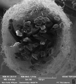 core/shell nanofibers Development of medical