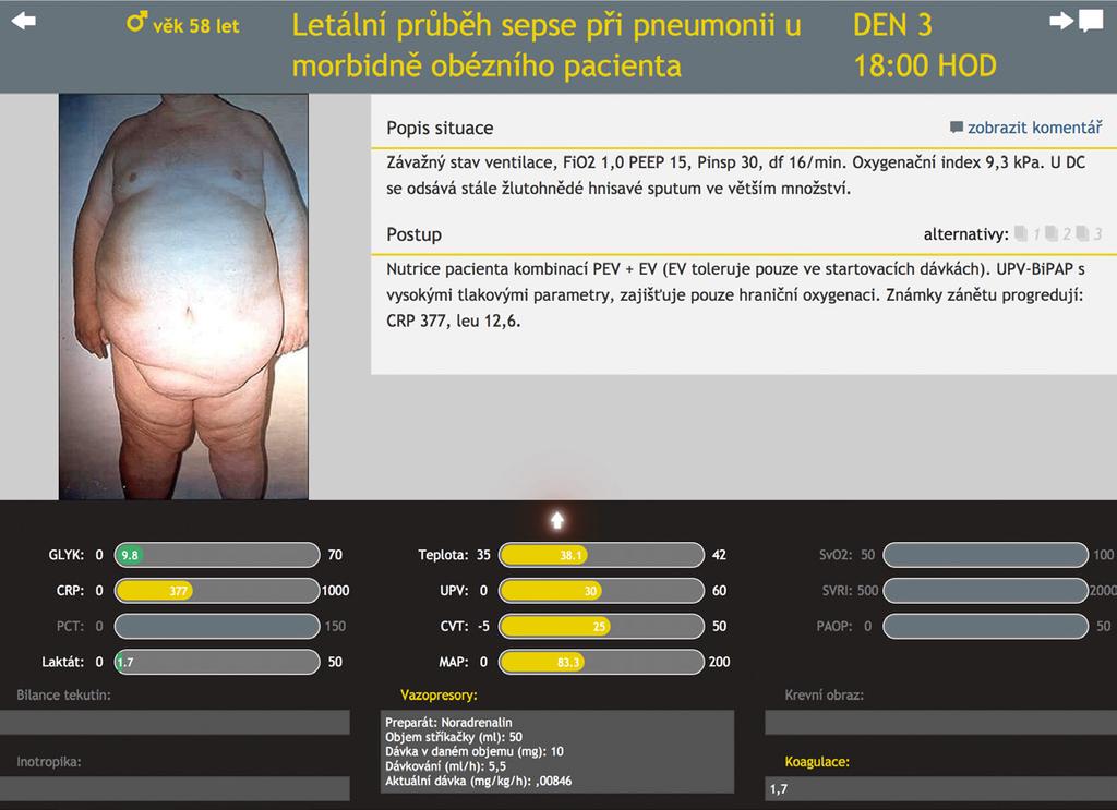 3 OBRÁZEK 1 Detail vybraného klinického scénáře. pacienta, po několika hodinách, dnech). Ke každému časovému bodu lze připojit ilustrační obrázky nebo videosekvence. CO JE KLINICKÝ SCÉNÁŘ?