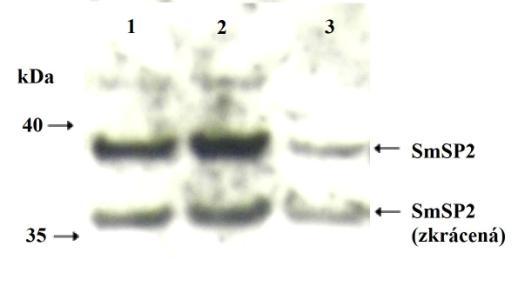 Obr. 16: SmSP2 analyzována pomocí imunodetekce. Byla provedena SDS-PAGE proteinů eluovaných z chromatografie SmSP2 na koloně Ni-NTA.