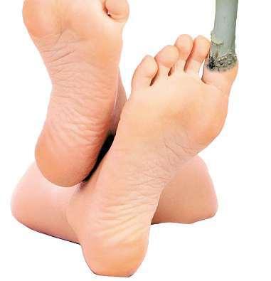 Vadí-li rukám mytí nádobí v saponátu nebo jiné čisticí přípravky, projeví se to i na nehtech. Ty se pak třepí alámou.