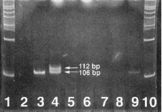 U člověka byly detekovány dvě kopie amelogeninového genu, jedna na X chromozomu v oblasti p22.1-p22.3 a druhá poblíž centromery Y chromozomu v lokusu p11.2 (viz obr. 8) (Schaefer et al. 1993).