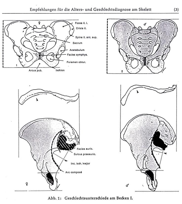 Morfoskopické znaky Mužská pánev vzhledem k ženské 1. vyšší a užší 2. cristae iliacae jsou více esovitě zakřivené 3. fossa iliaca je vyšší a užší 4. foramen obturatum je oválný 5.