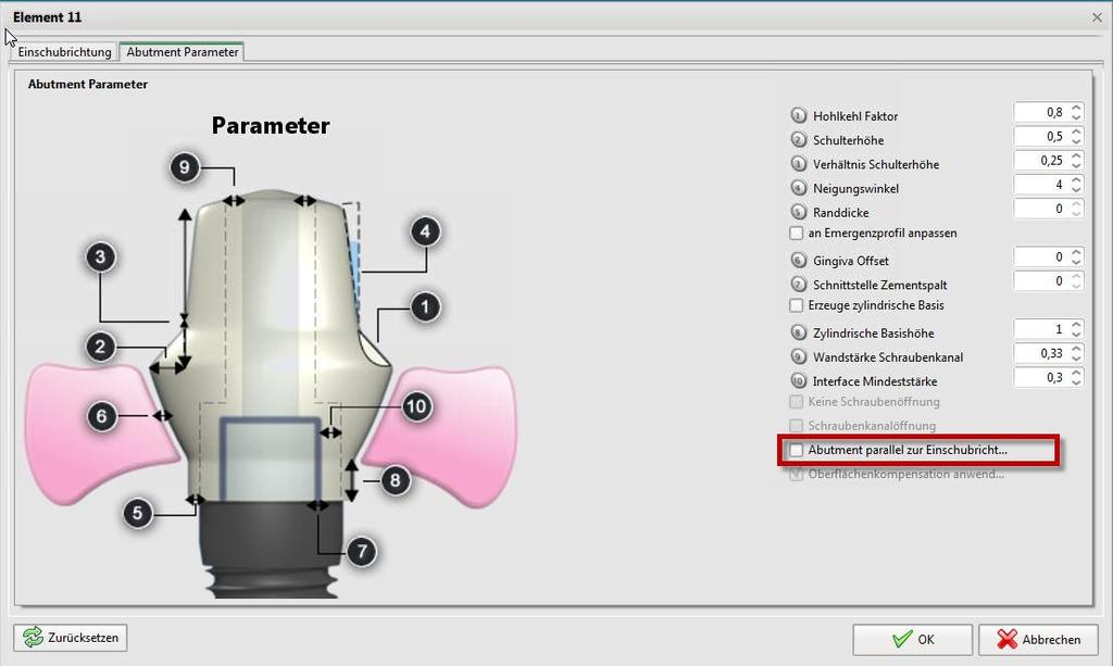 1.4 Individuální abutmenty paralelita k ose nasazení V okně Parametry