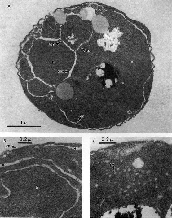 Accumulation of ER membranes