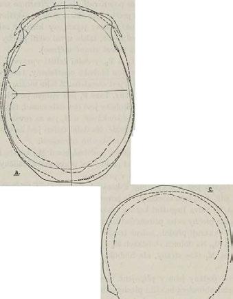 Coupe tra n sv e rsa le p a rle point auriculaire. Předni střední řez mezi ře z e m t a nejpřednějšim bodem /GL/ Coupe au milieu entre la coupe 1" et la glabelle.