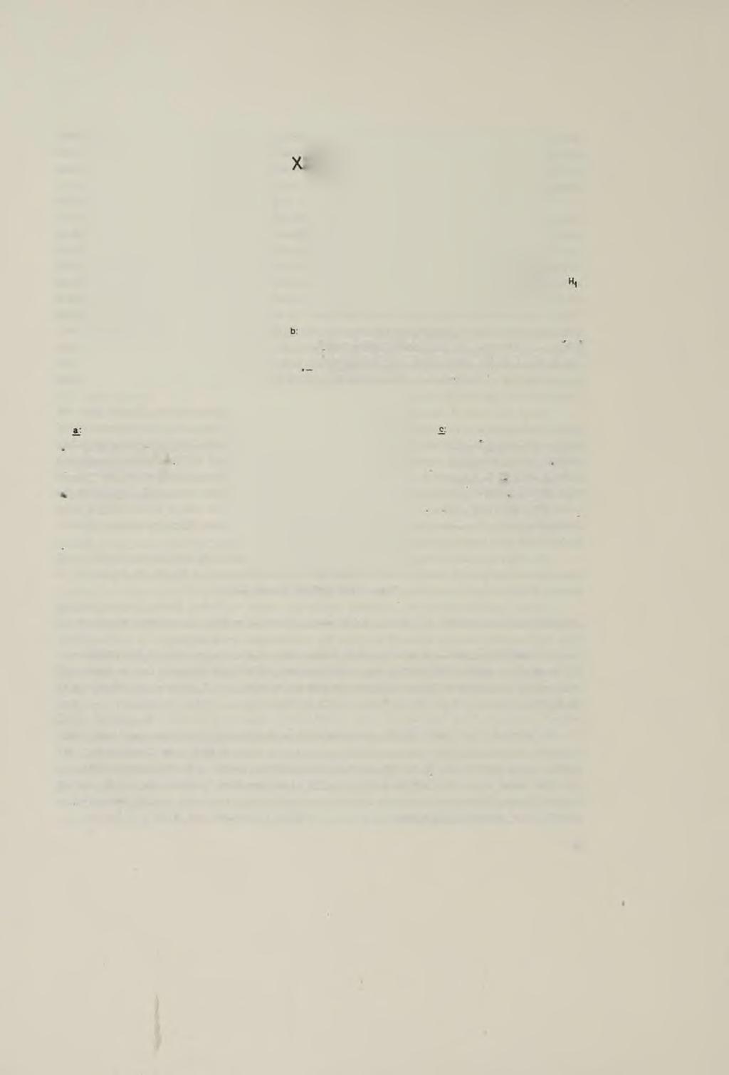 = ------- 1 Řez m ed ian n i - coupe m íd ia n e. -------------2 Řez vnitř okrajem očnice- Coupe p a r le bord interne de I orbile.