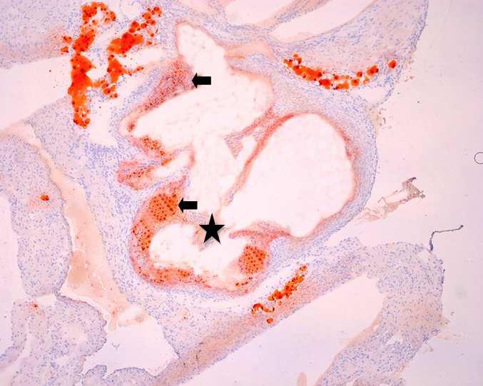 8.2 Histologické barvení olejovou červení Barvení olejovou červení bylo provedeno za účelem kvantifikace velikosti aterosklerotických plátů u myší krmených standardní dietou a u myší krmených