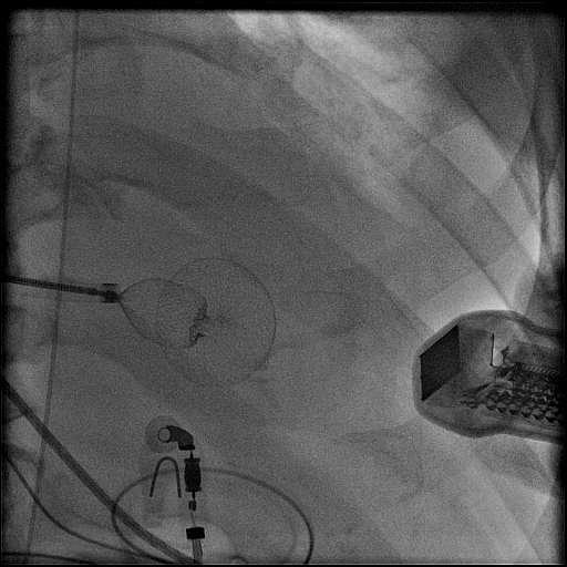 Implantace