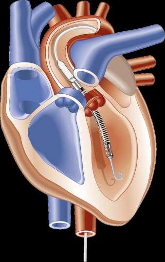 Cardiology
