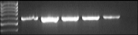Inhibice exprese mrna pro TNF-α nespecifickým antagonistou adenosinových receptorů CGS-15943 Acyklický nukleosidfosfonát N 6 -izobutyl-pmedap (50 µm) rychle a výrazně indukuje transkripci mrna pro