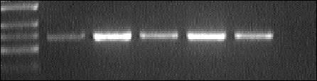 Inhibice exprese mrna pro IL-10 nespecifickým antagonistou adenosinových receptorů CGS-15943 Acyklický nukleosidfosfonát N 6 -izobutyl-pmedap (50 µm) zvyšuje transkripci mrna pro IL-10 a to již za 1