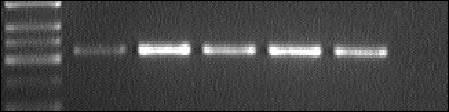 Inhibice exprese mrna pro RANTES/CCL5 nespecifickým antagonistou adenosinových receptorů CGS-15943 Acyklický nukleosidfosfonát N 6 -izobutyl-pmedap (50 μm) zvyšuje transkripci mrna pro RANTES a to