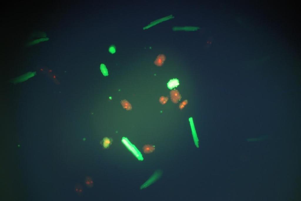 LIVE DEAD Viability/Cytotoxicity Kit od Invitrogenu Metoda spočívá v dvoubarevném zvýraznění, založeném na simultánním zjištění živých a mrtvých buněk pomocí dvou sond.