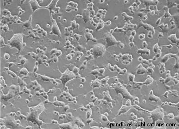 Cytopatický efekt (6) swelling and clumping: infikované buňky se zvětšují a postupně