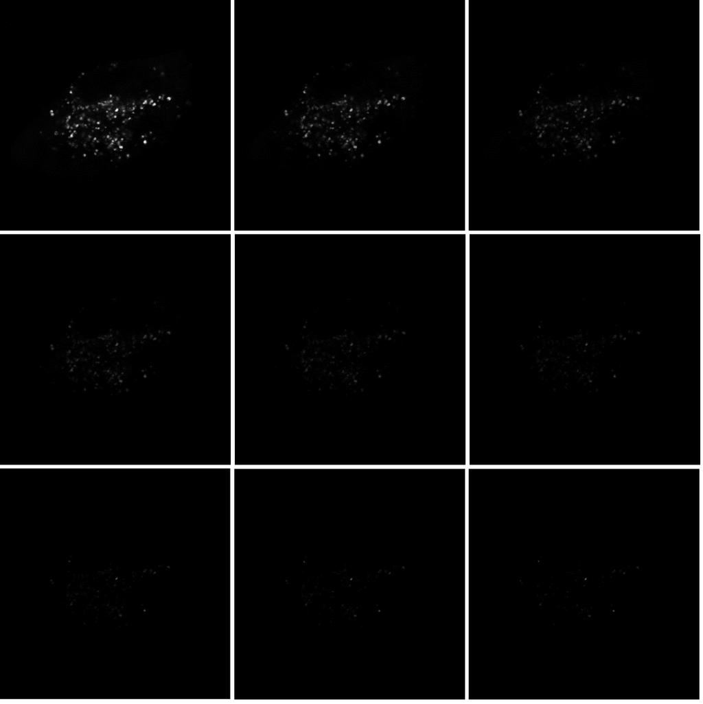 6.1.3 Získané fluorescenční snímky Při měření byly získány fluorescenční snímky za pomocí WLL laseru a funkce TimeGate, která umožňuje detekovat fluorescenční emisi pouze v čase mezi pulzy laseru, a