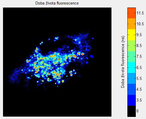 Obr. 26: Zobrazení doby života fluorescence mezenchymálních buněk a vliv různého nastavení prahu na výsledek 6.3 Metoda zobrazení 2D lambda skenu Obr.