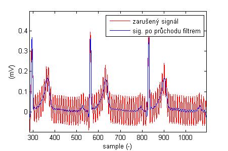 Nulování spektrálních čar odpovídajících kmitočtu rušení 50 Hz Obr. č. 35: Průběh EKG signálu s aditivní složkou rušení 50 Hz a detail průběhu signálu po odstranění rušení potlačením spektrálních čar pro kmitočet rušení 50 Hz Obr.