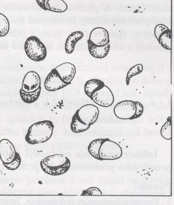 Obr. 9 - Nález cyst Giardia intestinalis v trusu.