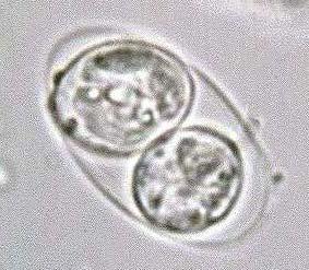 Doba inkubace - Bradyzoity. Jsou v cystách (tisíce až desetitisíce). Nacházíme, je zejména v kosterních svalech, bránici, myokardu, v mozku a dalších místech.