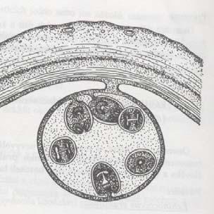 Obr. 45 - Echinokoková larvocysta.