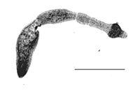 Diagnostika infekce Laboratorní diagnostika podobně jako u cystické echinokokózy je založená na důkazu specifických protilátek sérologickými metodami (ELISA, Western blot, imunofluorescenční test,