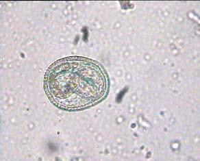 Diagnostika infekce Z diagnostických metod se používá sérologické vyšetření (ELISA), které je v 75 90 % pozitivní u oční formy a ve stádiu larva migrans visceralis.