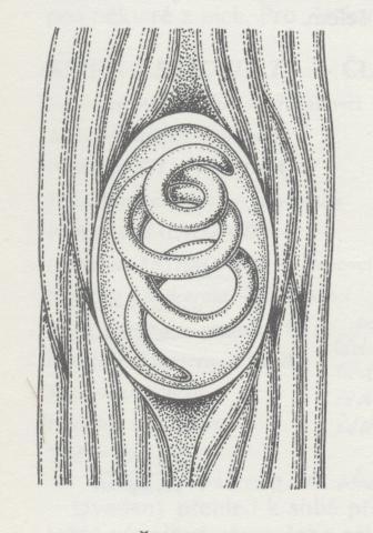 Obr. 84 - Trichinella