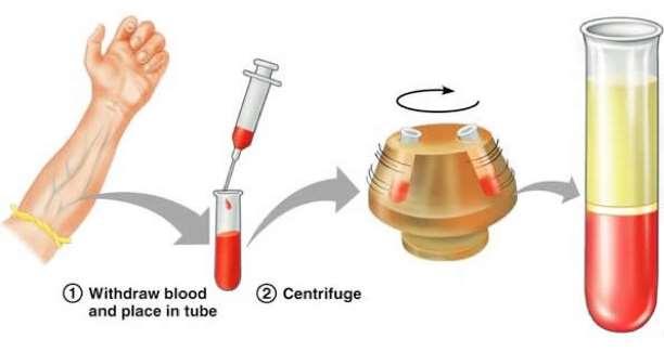 KREV Krev je tělní tekutina transportní médium (O 2, CO 2, metabolity, hormony, živiny.