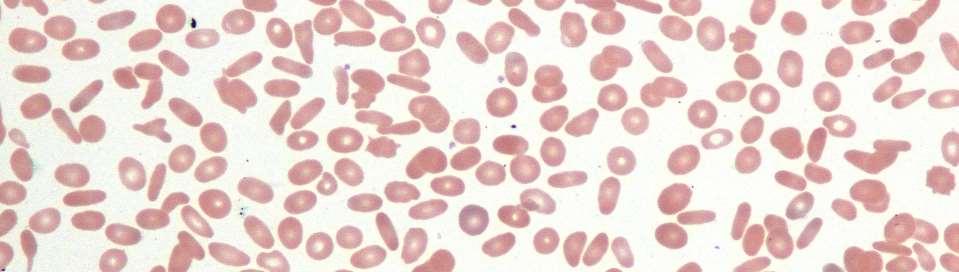 ERYTROCYTY