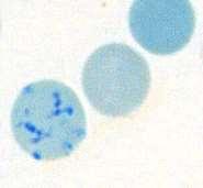 erytroblast erytrocyty