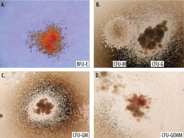 HEMATOPETICKÁ KMENOVÁ BUŇKA A PROGENITORY Hematopetická kmenová buňka Klidová, pomalý buněčný cyklus Transmembránový fosfoglykoprotein CD34 + - adheze v niche Neexprimuje