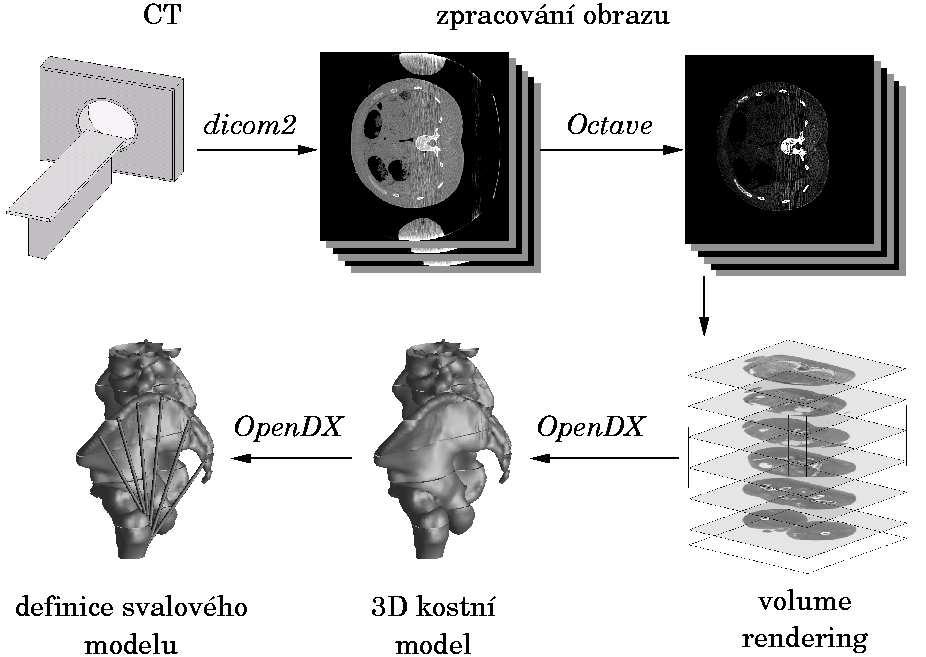 Kapitola 3 Anatomický model Anatomický model je založen na přímém určení svalově-kosterní geometrie z CT snímků 3.