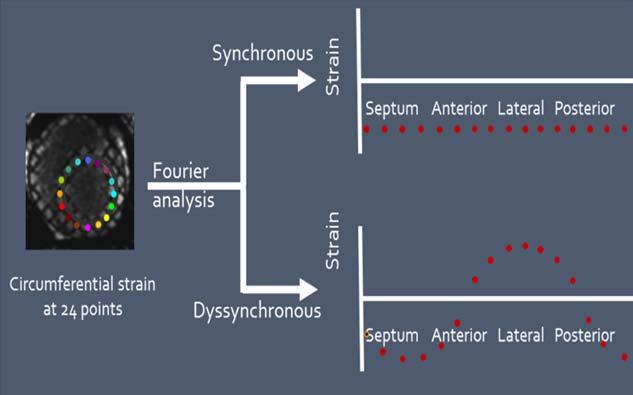 546 Circ Arrhythm Electrophysiol June 2014 Downloaded from http://circep.ahajournals.org/ by guest on November 10, 2017 Figure 3.