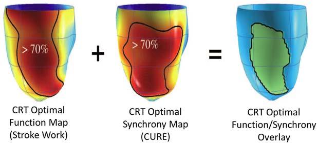 Note the simultaneous stretch (positive strain) and contraction (negative strain) occurring in opposing walls. Reprinted from Budge et al 29 with permission of the publisher. Elsevier (2012).