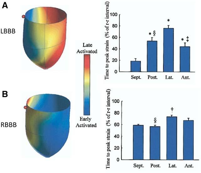 Bilchick LV Free Wall Pacing in RBBB 547 Downloaded from http://circep.ahajournals.