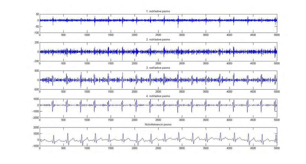 5.2 Výsledky experimentů Pro naše experimenty jsme využili výše zmíněné signály a šumovou složku EMG_model. mat.
