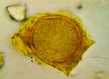 Rhizophydium pollinis-pini ( kuličky na pyl.