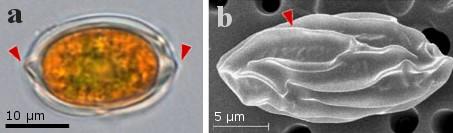 chloroplast a další struktury buňky (obr. 14). Méně často vzorky obsahují také buňky s výrazné strukturovanou stěnou, která je někdy považovaná za zygospory (Müller et al., 1998). Obr.