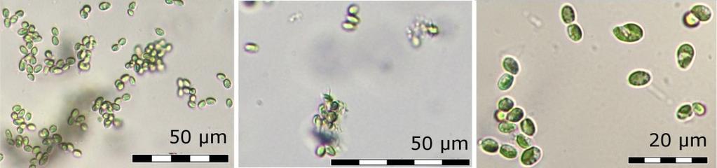 Nápadně odlišná byla kultura morfologicky odpovídající čeledi Scenedesmaceae z