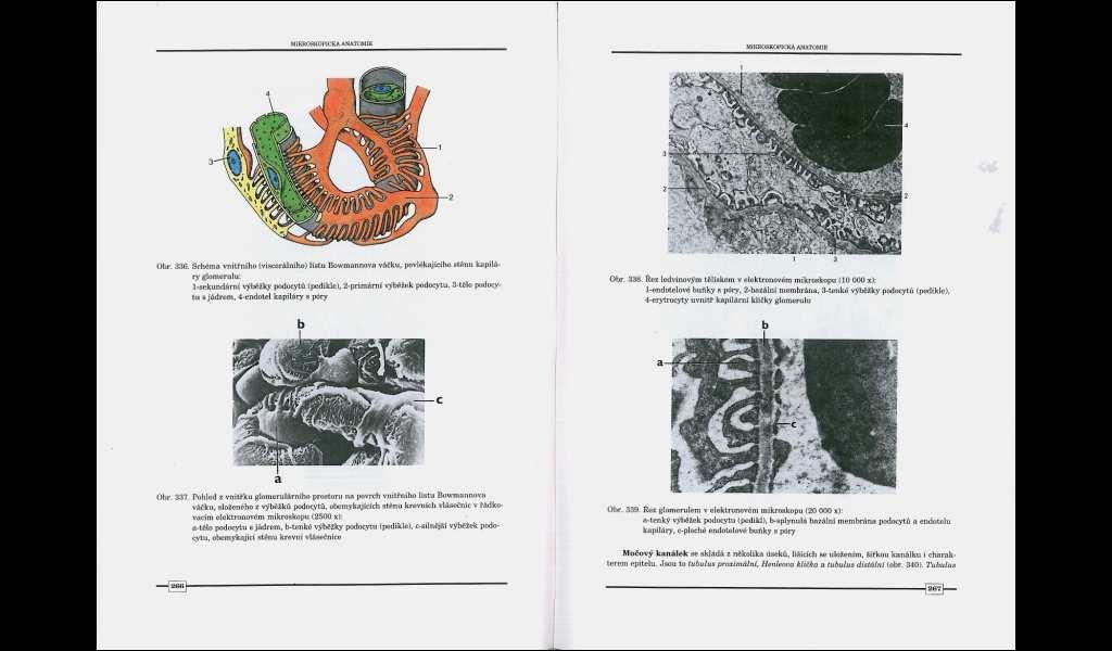 2. HISTOLOGIE A HISTOFYZIOLOFIE LEDVIN Histologicky má ledvina stavbu složené tubulózní žlázy. Co se jednotlivých částí nefronu týče a jejich histologické stavby (obr. 12