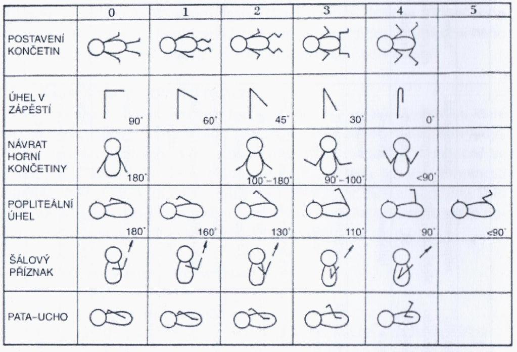 PŘÍLOHA P II: HODNOCENÍ NEUROMUSCULÁRNÍ ZRALOSTI DLE BALLARDA (Fendrychová, 2013, str.