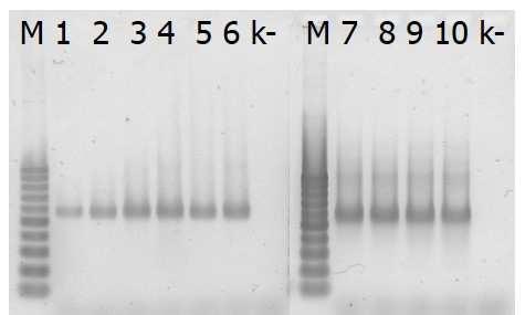 PCR s obecnými bakteriálními primery (Bac341F+Bac907R) byla provedena dle [2] za použití cykleru Biometra T-Personal. Z výsledků (Obr. 2) je patrná citlivost PCR.