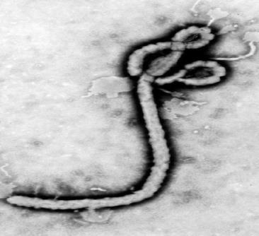 Jaké jsou příznaky a symptomy KHE? KHE začíná jako nespecifické horečnaté onemocnění se symptomy typickými pro virovou nemoc jako chřipka.