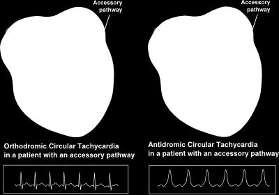 adenosin CaB,