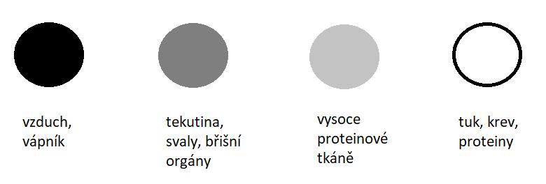 Obr. 1.2: Relaxační čas T1, zdroj: [40] Obr. 1.3: Relaxační čas T2, zdroj: [40] Obr. 1.4: Příklad barev a tkání T1 váhované sekvence, zdroj: [32] informace v prostoru.